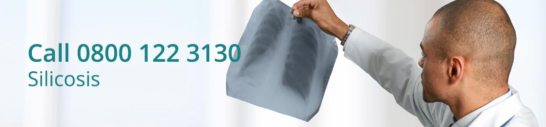Types Of Silicosis Mercury Legal
